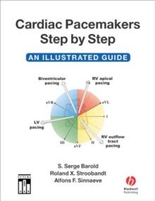 Cardiac Pacemakers Step by Step : An Illustrated Guide