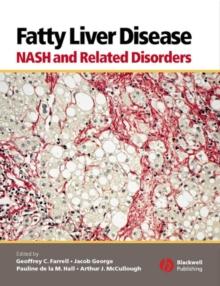 Fatty Liver Disease : NASH and Related Disorders