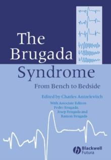 The Brugada Syndrome : From Bench To Bedside