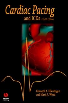 Cardiac Pacing and ICDs