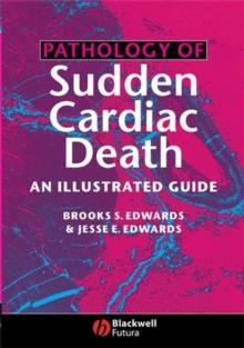 Pathology of Sudden Cardiac Death : An Illustrated Guide