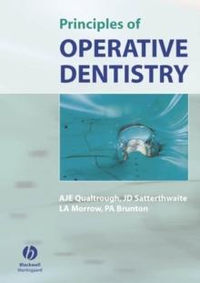 Principles of Operative Dentistry