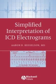 Simplified Interpretation of ICD Electrograms