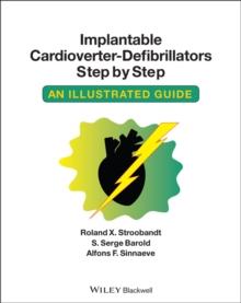 Implantable Cardioverter - Defibrillators Step by Step : An Illustrated Guide