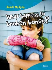 What Happens to Broken Bones?