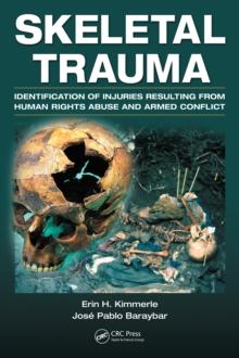 Skeletal Trauma : Identification of Injuries Resulting from Human Rights Abuse and Armed Conflict