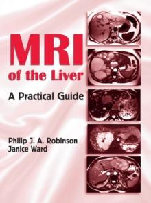 MRI of the Liver : A Practical Guide