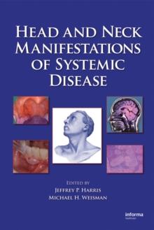 Head and Neck Manifestations of Systemic Disease