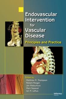 Endovascular Intervention for Vascular Disease : Principles and Practice