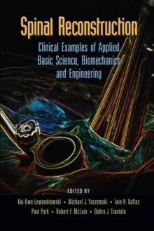 Spinal Reconstruction : Clinical Examples of Applied Basic Science, Biomechanics and Engineering