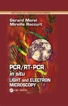 PCR/RT- PCR in situ : Light and Electron Microscopy