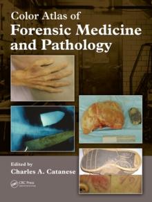 Color Atlas of Forensic Medicine and Pathology