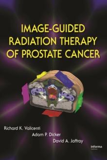 Image-Guided Radiation Therapy of Prostate Cancer