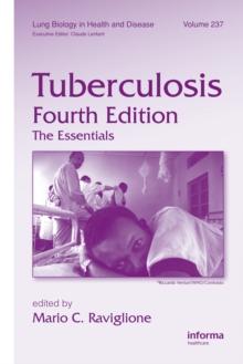 Tuberculosis : The Essentials, Fourth Edition