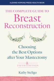 The Complete Guide to Breast Reconstruction : Choosing the Best Options after Your Mastectomy