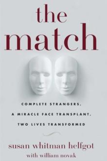 The Match : Complete Strangers, a Miracle Face Transplant, Two Lives Transformed