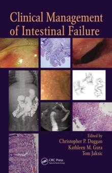 Clinical Management of Intestinal Failure