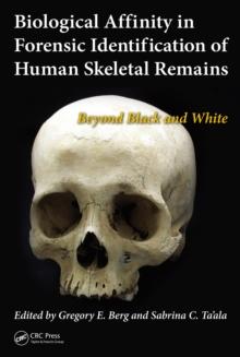 Biological Affinity in Forensic Identification of Human Skeletal Remains : Beyond Black and White