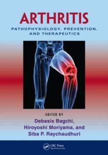 Arthritis : Pathophysiology, Prevention, and Therapeutics