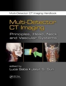 Multi-Detector CT Imaging : Principles, Head, Neck, and Vascular Systems