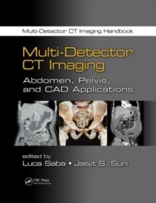 Multi-Detector CT Imaging : Abdomen, Pelvis, and CAD Applications