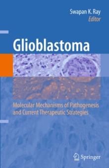 Glioblastoma: : Molecular Mechanisms of Pathogenesis and Current Therapeutic Strategies