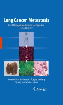 Lung Cancer Metastasis : Novel Biological Mechanisms and Impact on Clinical Practice