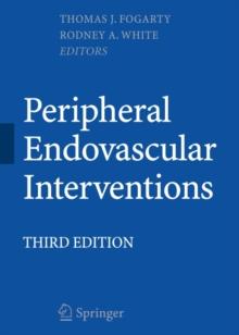 Peripheral Endovascular Interventions