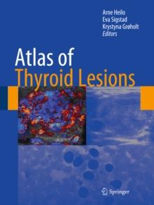 Atlas of Thyroid Lesions