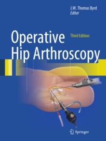 Operative Hip Arthroscopy