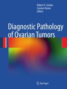 Diagnostic Pathology of Ovarian Tumors