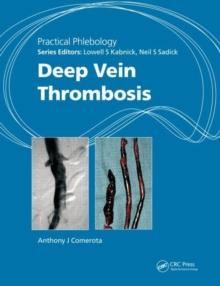 Practical Phlebology : Deep Vein Thrombosis