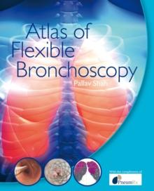 Atlas of Flexible Bronchoscopy