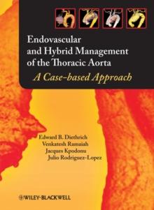 Endovascular and Hybrid Management of the Thoracic Aorta : A Case-based Approach