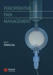 Perioperative Pain Management