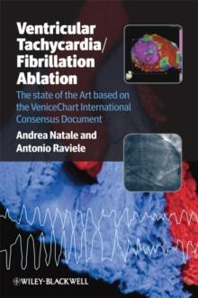 Ventricular Tachycardia / Fibrillation Ablation : The state of the Art based on the VeniceChart International Consensus Document