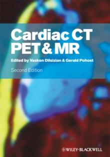 Cardiac CT, PET and MR