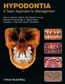 Hypodontia : A Team Approach to Management