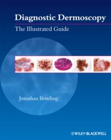 Diagnostic Dermoscopy : The Illustrated Guide