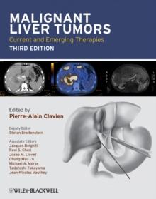 Malignant Liver Tumors : Current and Emerging Therapies