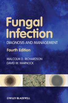 Fungal Infection : Diagnosis and Management