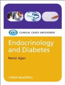 Endocrinology and Diabetes, eTextbook : Clinical Cases Uncovered