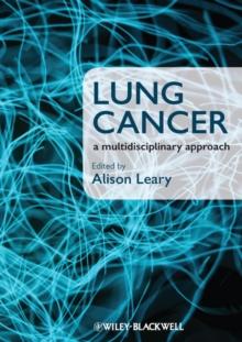 Lung Cancer : A Multidisciplinary Approach