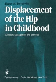 Displacement of the Hip in Childhood : Aetiology, Management and Sequelae