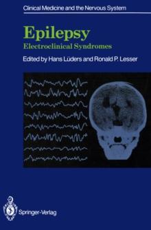 Epilepsy : Electroclinical Syndromes