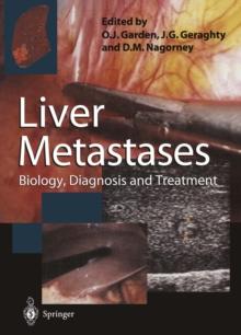 Liver Metastases : Biology, Diagnosis and Treatment