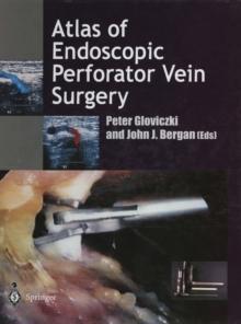 Atlas of Endoscopic Perforator Vein Surgery