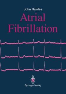 Atrial Fibrillation