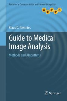 Guide to Medical Image Analysis : Methods and Algorithms