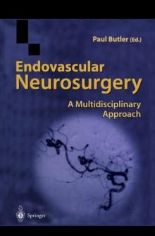 Endovascular Neurosurgery : A Multidisciplinary Approach